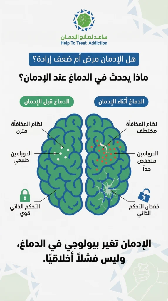 مخطط يوضح تأثير الإدمان على الدماغ قبل الإدمان وأثناءه، واختلال نظام المكافأة وانخفاض الدوبامين وفقدان التحكم الذاتي